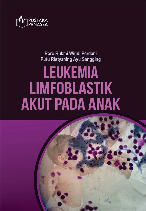 Leukemia Limfoblastik Akut Pada Anak